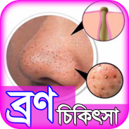 bron dur korar upay or tips ~ ব্রণ দূর করার উপায় screenshot 2