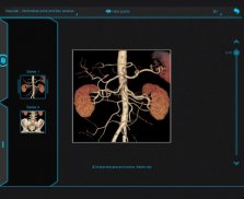 Atlas de Anatomia Radiológica screenshot 4