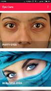 Eye Care - Eye Exercises, Dark Circles, Eyebrows screenshot 1