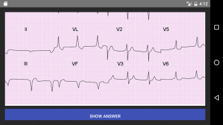 ECG 100 Clinical Cases screenshot 4