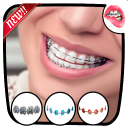 Braces Teeth  Photo Editor