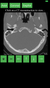 CT Cervical Spine screenshot 1