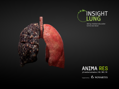 INSIGHT LUNG screenshot 10