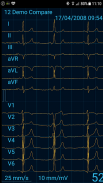 Cardiax Mobile EKG screenshot 8