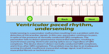 ECG Rhythm Quiz screenshot 7