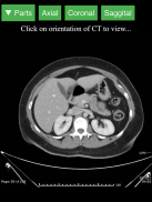 Radiology CT Viewer screenshot 5