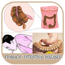 All Stomach Disease &Treatment