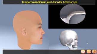 TMJ Arthroscope screenshot 3