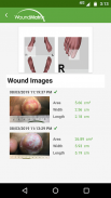 WoundMatrix Patient screenshot 0