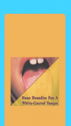 Home Remedies For A White-Coated Tongue screenshot 0