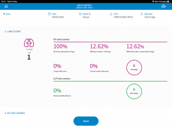 Ceva Lung Program screenshot 1