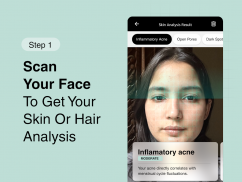 Cureskin: Skin & Hair Experts screenshot 10