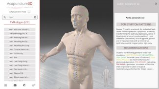 Acupuncture 3D screenshot 2