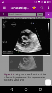 Echocardiography screenshot 0