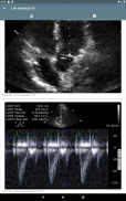 ResUS screenshot 7