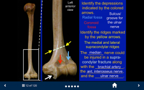 MSK Anatomy - SecondLook screenshot 3