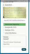 Diagnose ECG screenshot 3