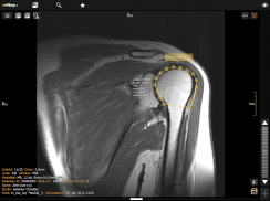 mRay - DICOM Viewer screenshot 8