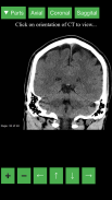 Radiology CT Viewer screenshot 2