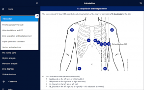 ECG APPtitude screenshot 4