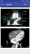 CT Scan Cross Sectional Anatomy screenshot 6