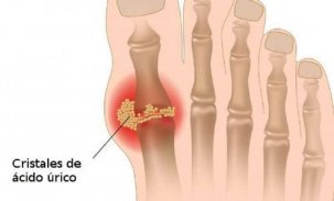 Uric acid tips screenshot 3