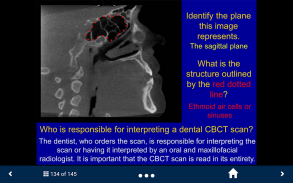 Oral Radiology - SecondLook screenshot 4