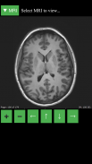 MRI Viewer screenshot 0