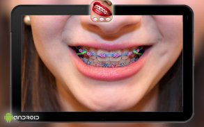 Real Teeth Braces Camera screenshot 1