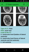 CT Brain screenshot 2