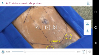 Videoatlas Laparoscopia Lubeck screenshot 0