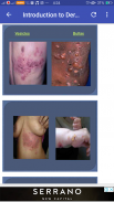 Basics of All Skin Diseases screenshot 1