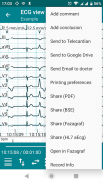 DiaCard - ECG Recorder screenshot 20