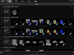 mRay - DICOM Viewer screenshot 5