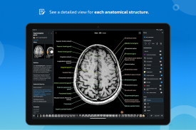 e-Anatomy screenshot 6