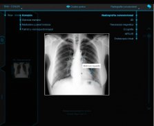 Atlas de Anatomia Radiológica screenshot 2