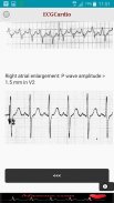 ECGCardio screenshot 9