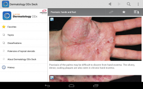 Dermatology DDx screenshot 11