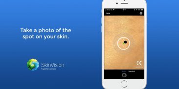 SkinVision - Detect Skin Cancer screenshot 3