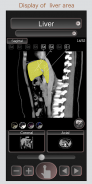 CT PassportLite Abdomen / sectional anatomy / MRI screenshot 3