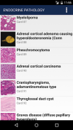 Anatomic Pathology Flashcards screenshot 18