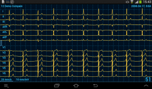 Cardiax Mobile ECG screenshot 0