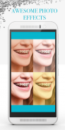 Braces Photo Editor - Beauty editor screenshot 5