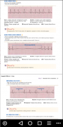ECG / EKG Rhythm Step-by-Step Interpretation screenshot 1