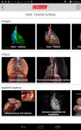 HEART - Digital Anatomy Atlas screenshot 14