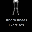 Knock Knees Exercises