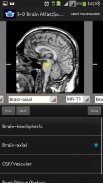 3-D brain Atlas screenshot 1