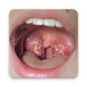 Tonsils Home Remedy Icon