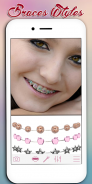 Braces Photo Editor screenshot 9