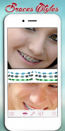 Braces Photo Editor screenshot 8